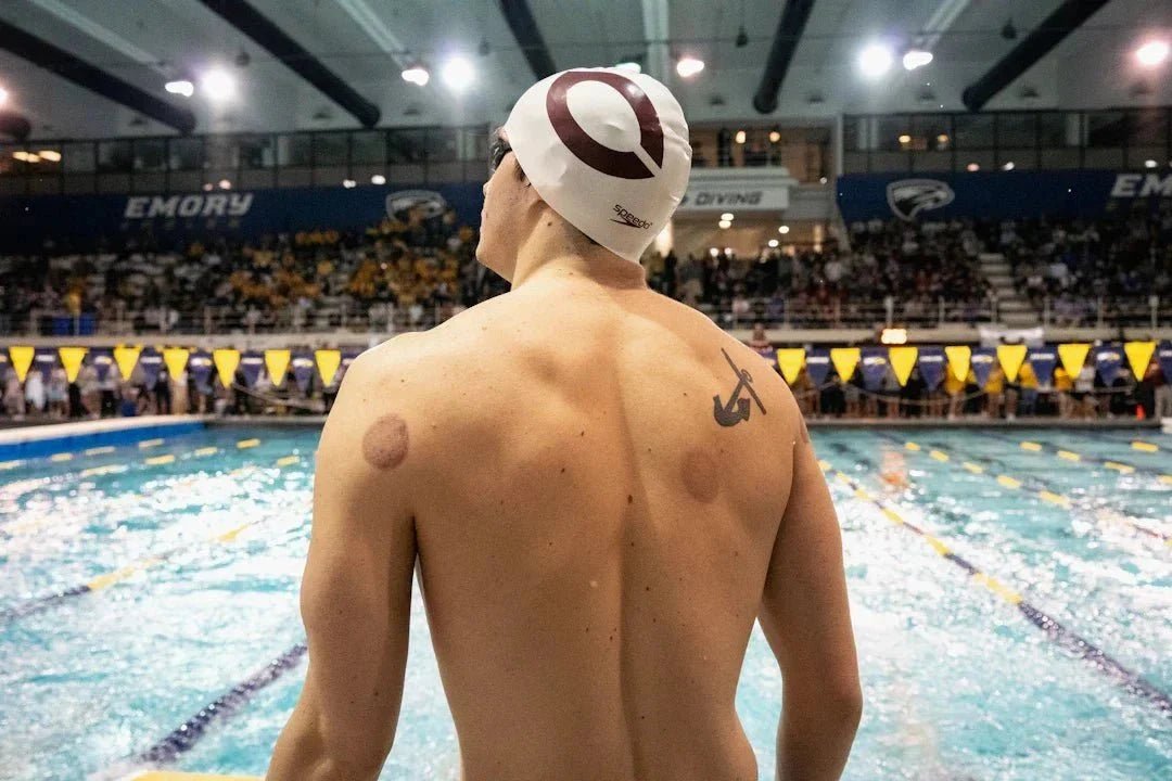 Enhance Your Self-Care Routine with Cupping Devices - Kiicity
