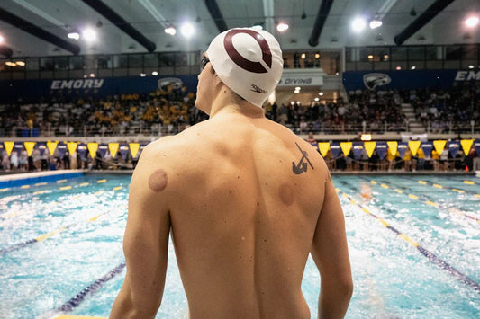 Enhance Your Self-Care Routine with Cupping Devices - Kiicity